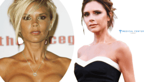 Which Celebrities got Breast Implants?