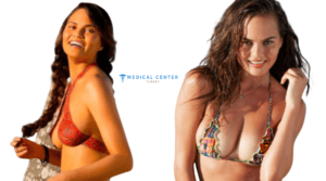Which Celebrities got Breast Implants?