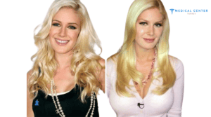Which Celebrities got Breast Implants?