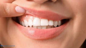 Why Do People Go to Turkey for Dental Treatment?