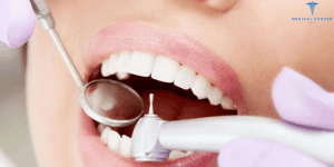 Why Do People Go to Turkey for Dental Treatment?