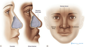 Why is 2026 the Best Year to Get a Nose Job?
