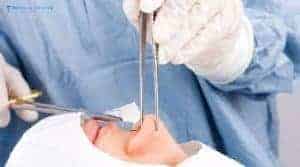 Why Is Preservation Rhinoplasty So Popular in 2026?