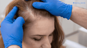 Zoya’s Hair Transplant Experiences in Turkey 