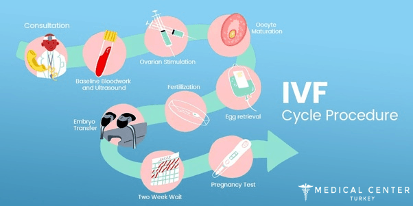 IVF-treatment