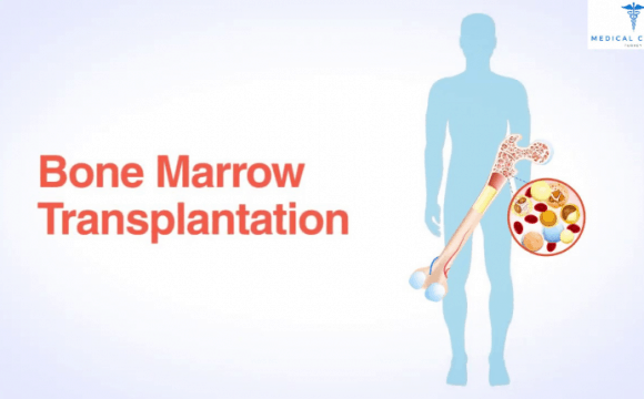Bone marrow transplantation in Turkey