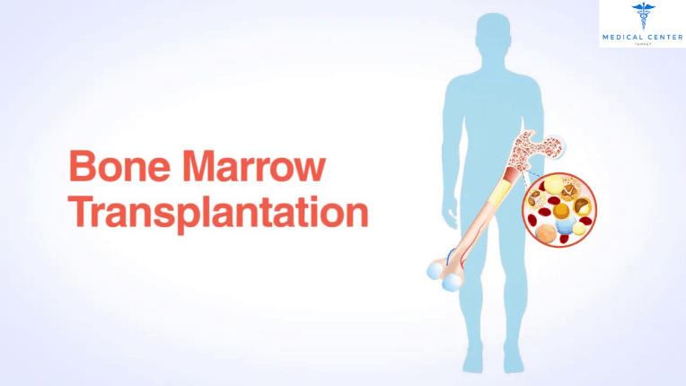 Bone marrow transplantation in Turkey
