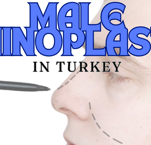 Male Rhinoplasty in Turkey