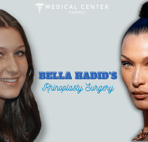Bella Hadid's Rhinoplasty Surgery