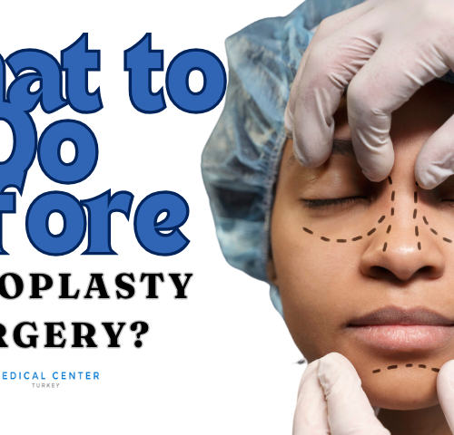What to Do Before Rhinoplasty Surgery?