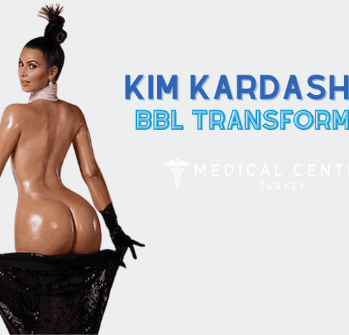 Does Kim Kardashian end the BBL Era?