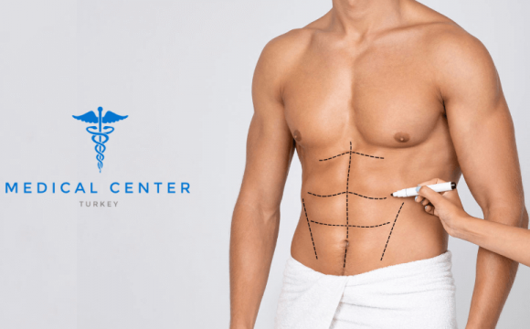 A Complete Guide to Liposuction for Men