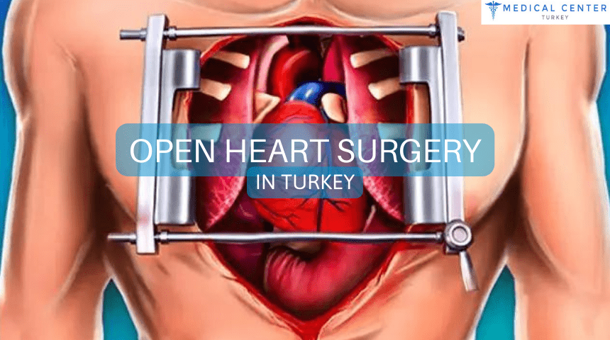 Open Heart Surgery in Turkey