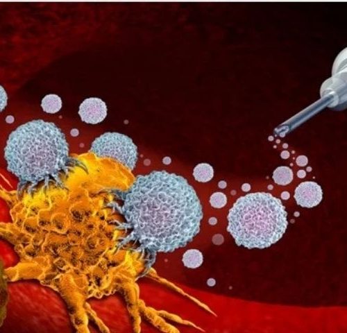 Immunotherapy in Turkey Immunotherapy in Turkey
