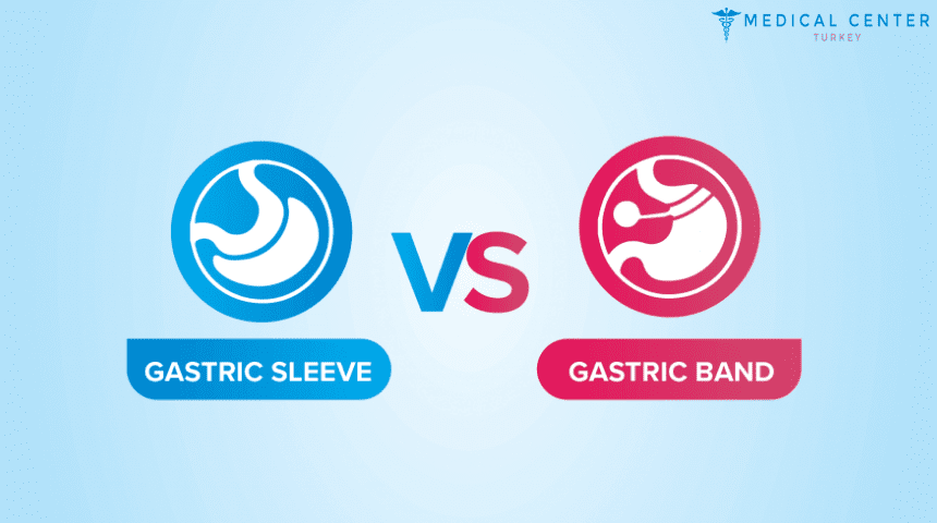 Gastric Band vs Gastric Sleeve