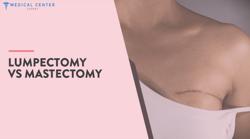 Lumpectomy vs Mastectomy