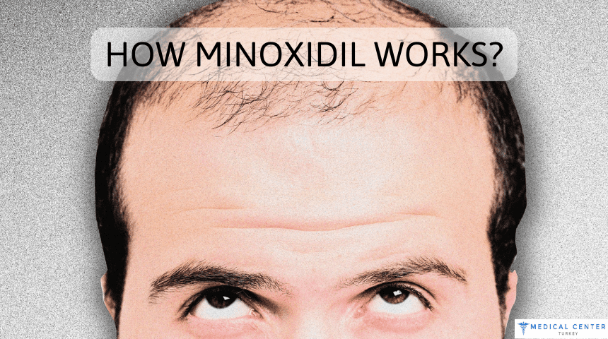 How Minoxidil Works?
