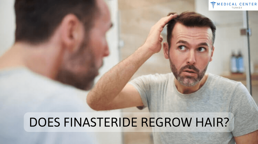 Does Finasteride Regrow Hair?