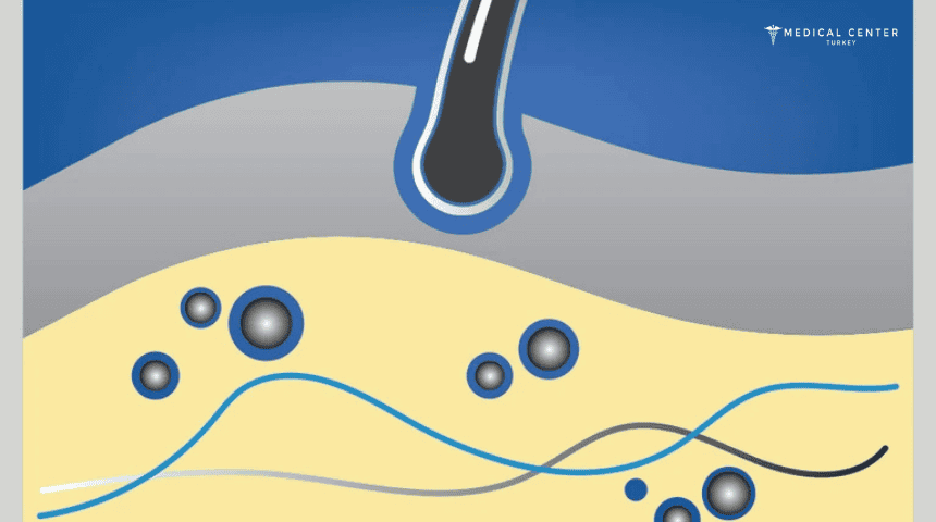 How Minoxidil Works? How Minoxidil Works?