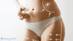 Best Countries for Liposuction