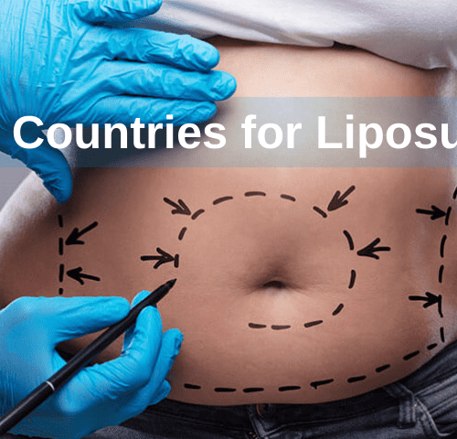 Best Countries for Liposuction