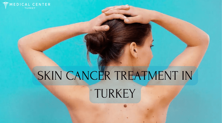 Skin Cancer Treatment in Turkey
