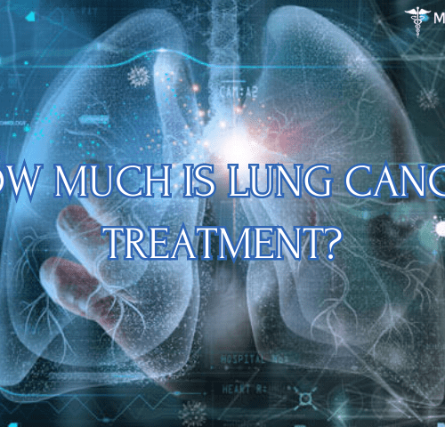 How Much is Lung Cancer Treatment?