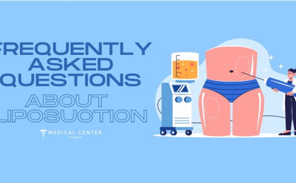 Frequently Asked Questions About Liposuction