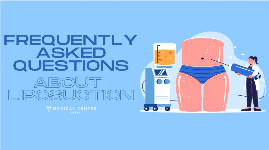 Frequently Asked Questions About Liposuction
