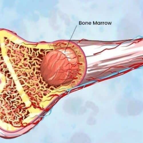 How Long is Bone Marrow Transplant?