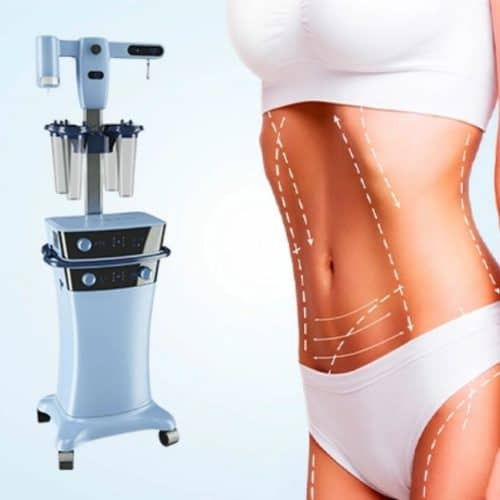 Vaser Liposuction Turkey Before and After Vaser Liposuction Turkey Before and After