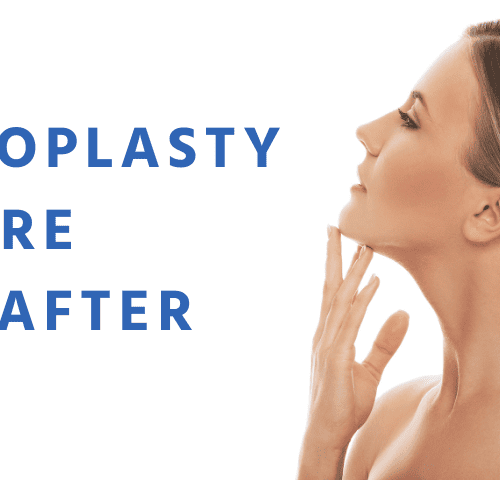 Rhinoplast (Nose Job) Before and After Turkey