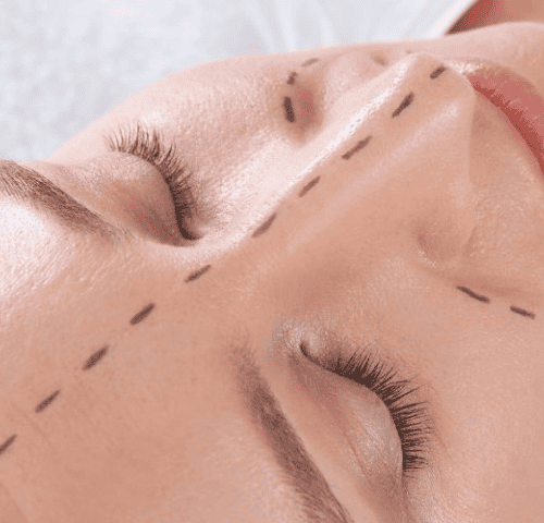 The 5 Best Countries for Rhinoplasty Surgery