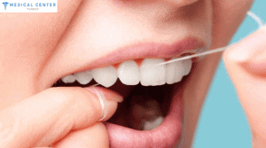 How Long Does a Dental Crown Last?