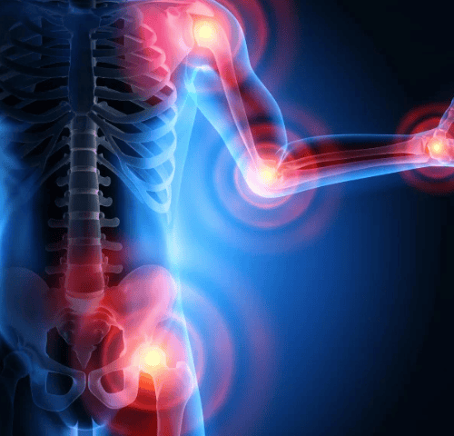 How is spinal osteoarthritis treated in Turkey?