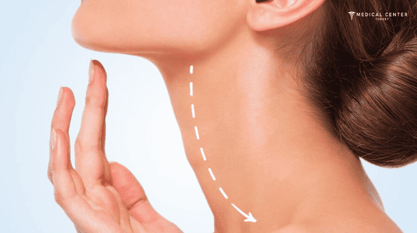 Neck Lift Cost in Turkey Neck Lift Cost in Turkey