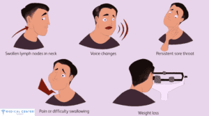 Throat Cancer