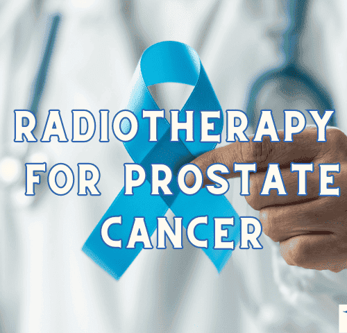 RADIOTHERAPY FOR PROSTATE CANCER
