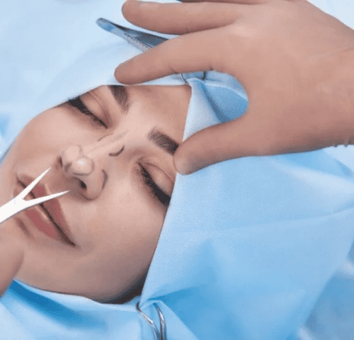 Is Nose Job Painful?