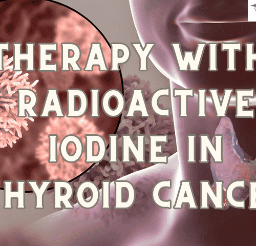 Therapy with Radioactive Iodine in Thyroid Cancer