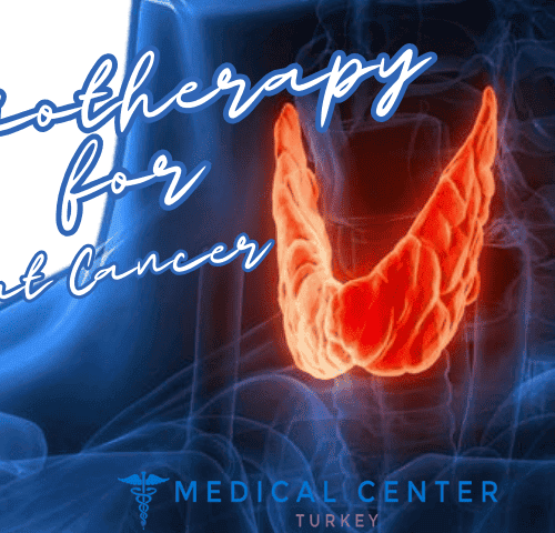 Radiotheraphy For Throt Cancer