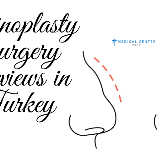 Rhinoplasty Surgery Reviews in Turkey