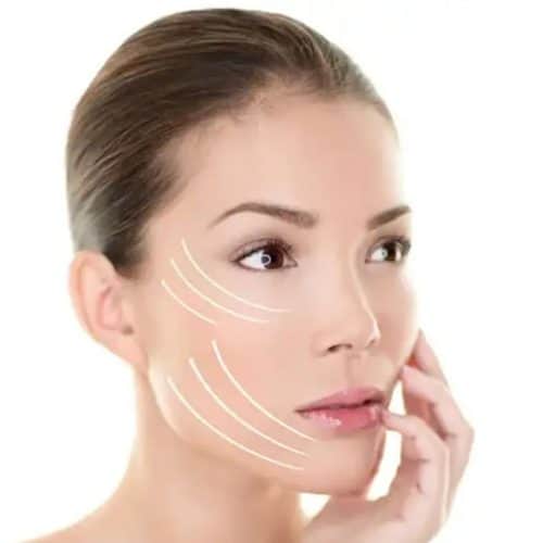 How Much is Facelift in Turkey? How Much is Facelift in Turkey?