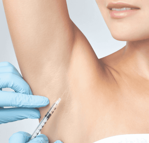 Botox for Armpit Sweat Botox for Armpit Sweat