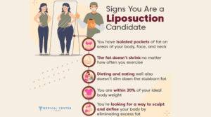 Liposuction Healing Time