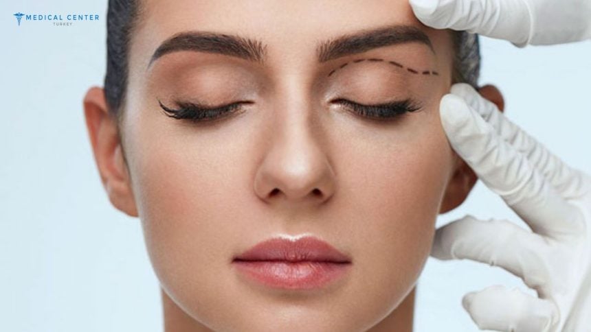 Eyelid Surgery (Blepharoplasty) Techniques in Turkey Eyelid Surgery (Blepharoplasty) Techniques in Turkey
