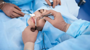 What You Need to Know Before Getting a Nose Surgery