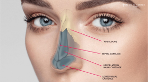 Latest Nose Surgery Techniques in Turkey