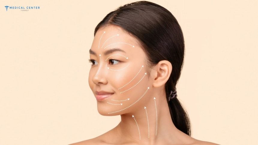 What to Expect After the Neck Lift Surgery in Turkey?