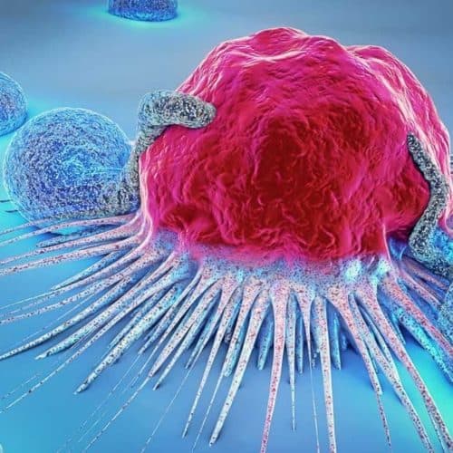 Is There a Cure for Cancer? Is There a Cure for Cancer?